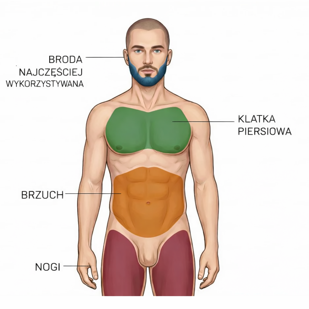 Mapa obszarów dawczych przy przeszczepie włosów z ciała – broda, klatka piersiowa, brzuch i nogi zaznaczone na sylwetce mężczyzny