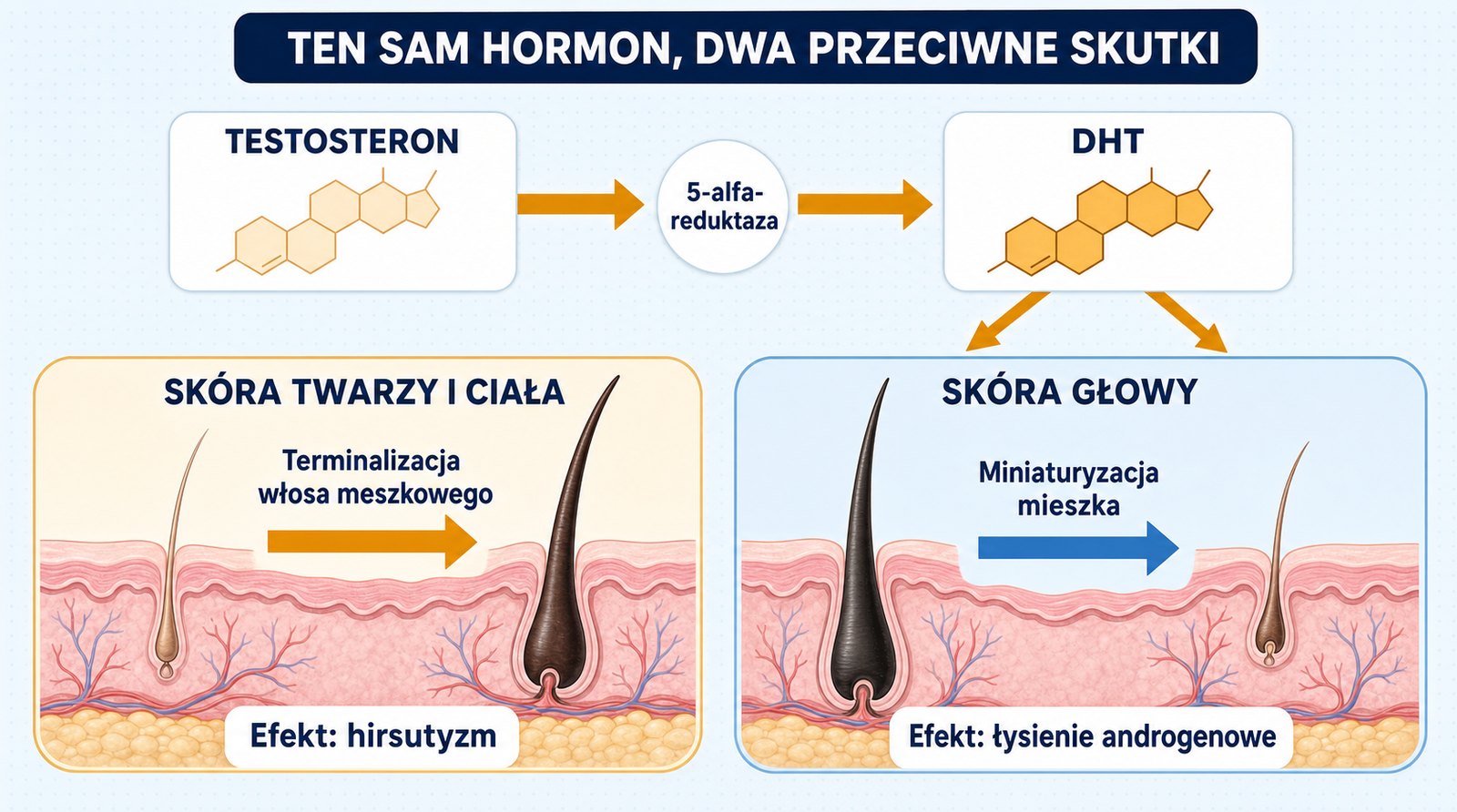 Działanie DHT: terminalizacja włosa na twarzy i ciele oraz miniaturyzacja mieszka na skórze głowy