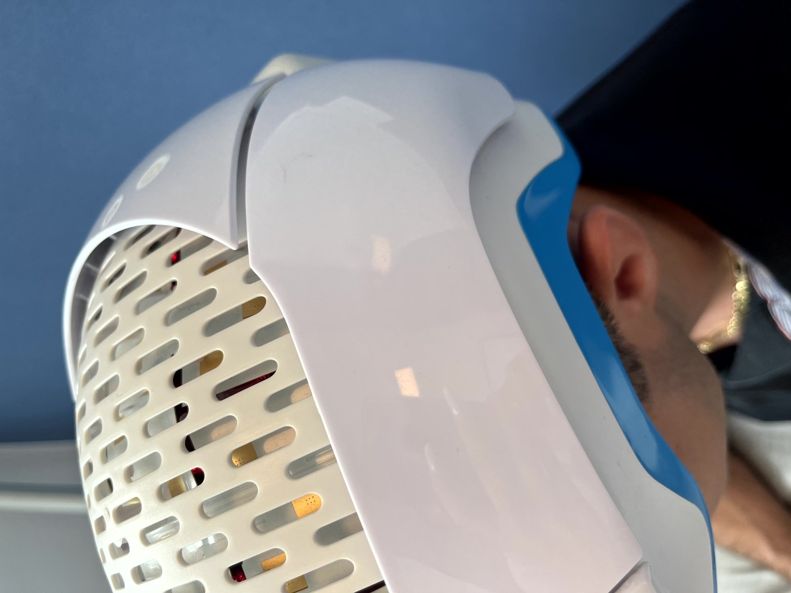 Laseroterapia LLLT - hełm laserowy Theradome podczas zabiegu