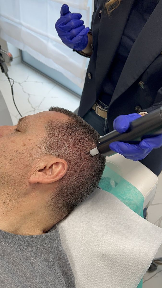 Specjalistka Perfect Hair Clinic podczas zabiegu przy linii włosów pacjenta